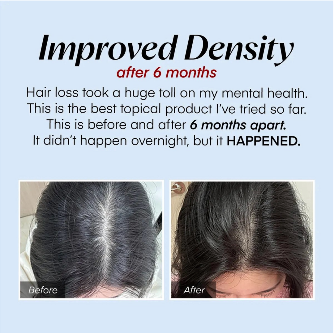 Seapuri - Scalpy Hair Serum