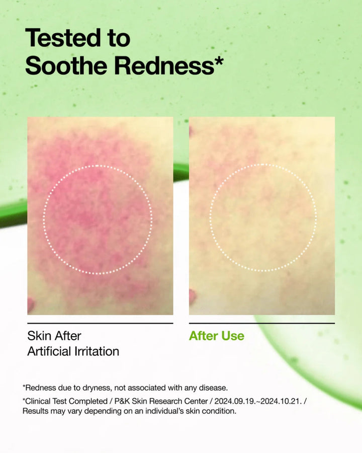 Anua - Azelaic Acid 10 Hyaluron Redness Soothing Serum